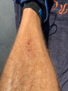 2020-06-19-pedal-bite